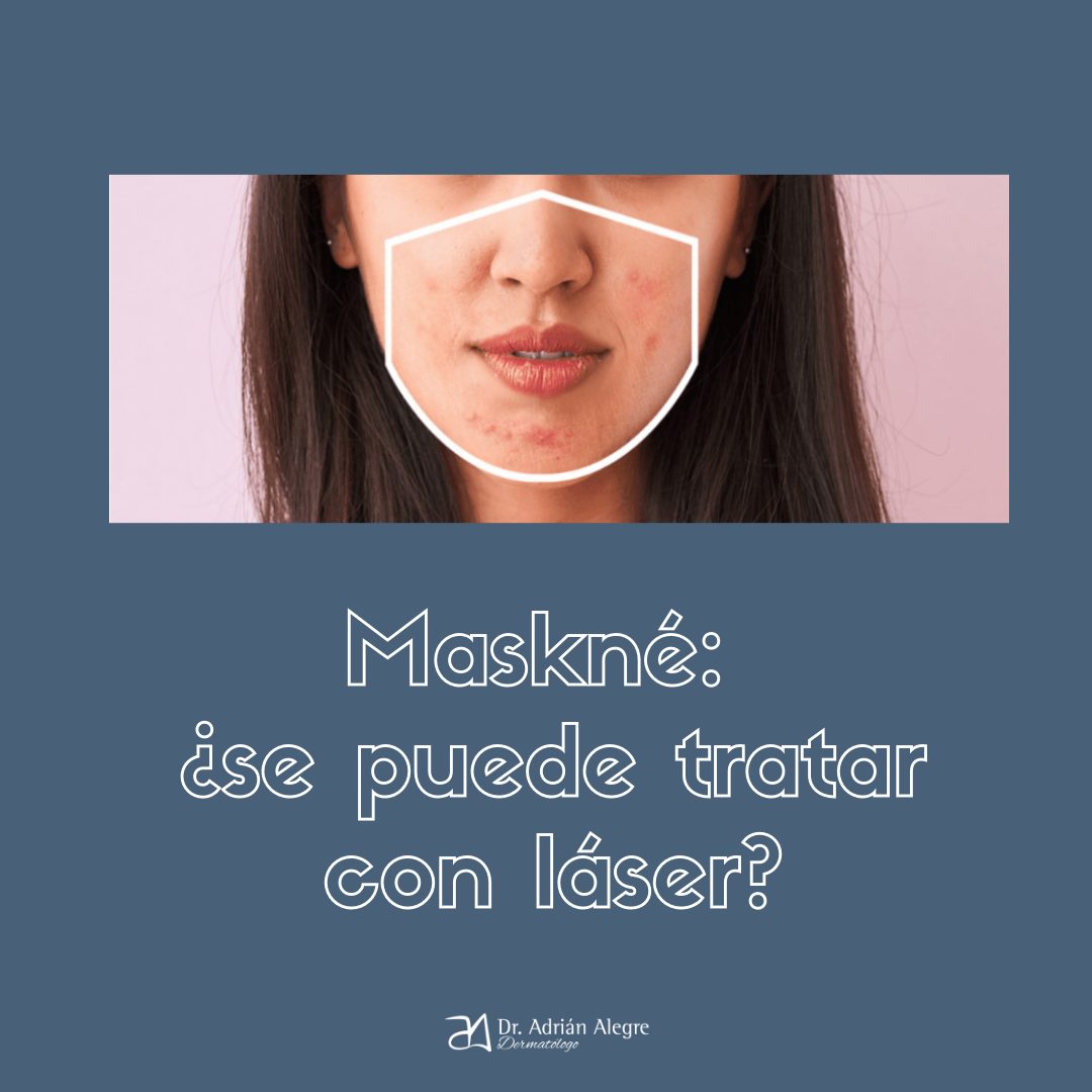 ;askne